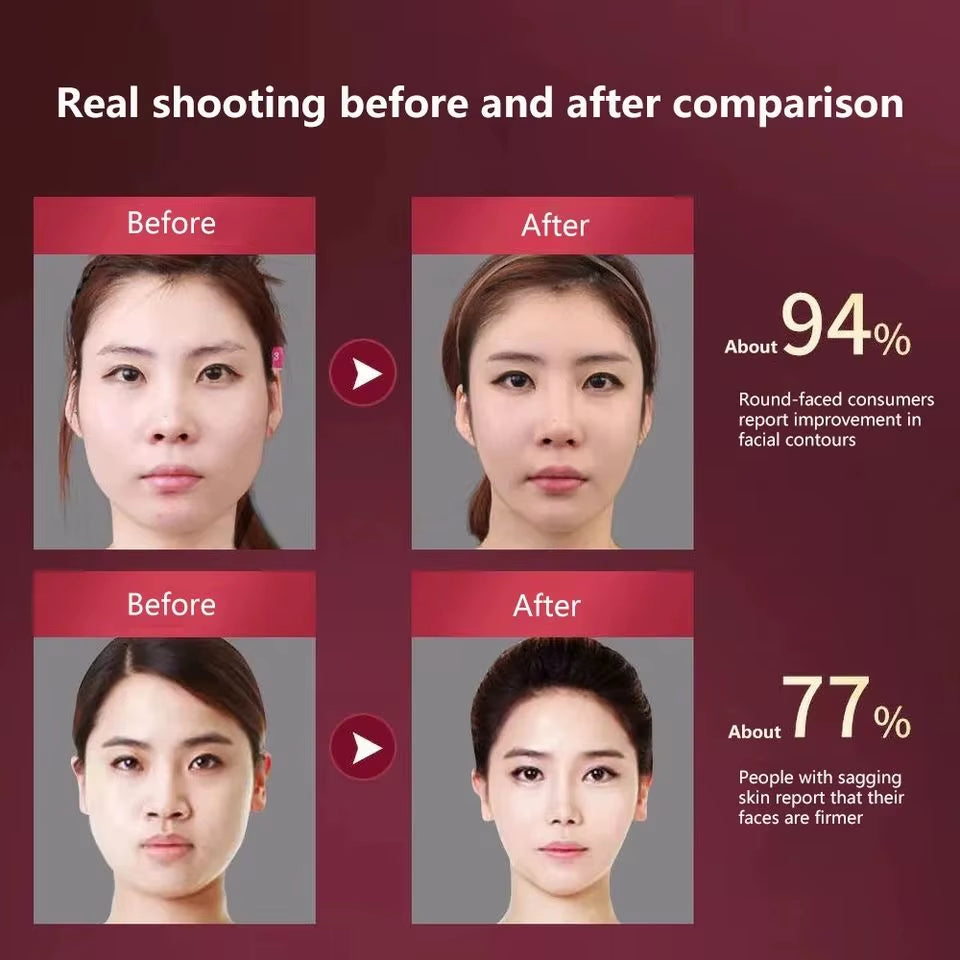 LED Photon Therapy Facial Slimming and Lifting Vibration Massager with Heating Function for Double Chin Reduction